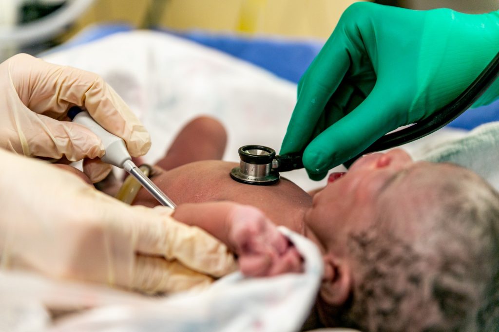 a newborn baby's heartbeat is check by doctors with a stethescope
