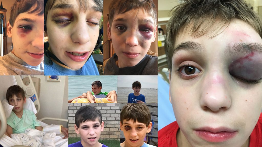 a collage of 9 Photos of Bryan Loftin, his face bruised