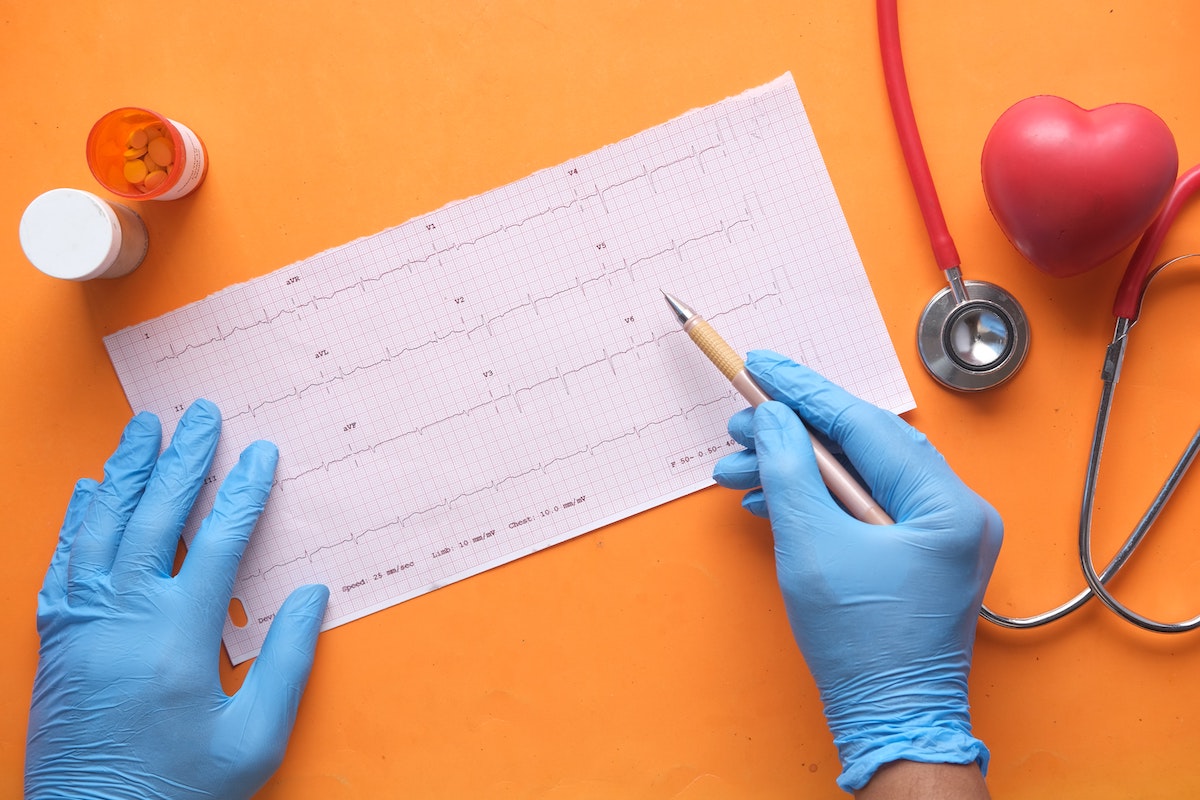 A stock image of a doctor's hands with blue gloves pointing at an EKG scan with a pencil, along with a stethoscope and opened pill bottle. Mississippians need access to cardiovascular disease treatments.