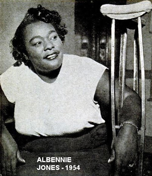 Photo of Albennie Jones 1954 holding crutches