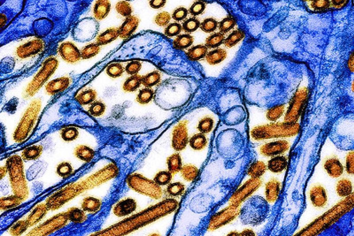 colorized electron microscope image of a virus shown in blue and yellow
