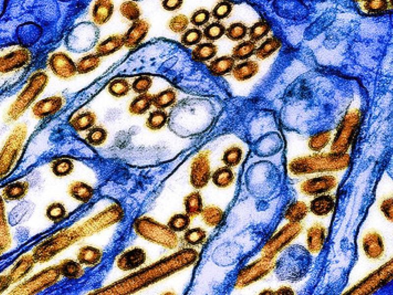 colorized electron microscope image of a virus shown in blue and yellow