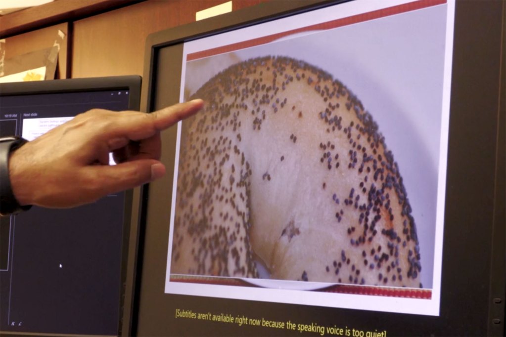A hand points to a photo of a poppy seed bagel