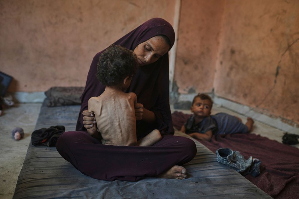 A woman wearing a dress and headshawl holds a small malnourished two year old child in her lap