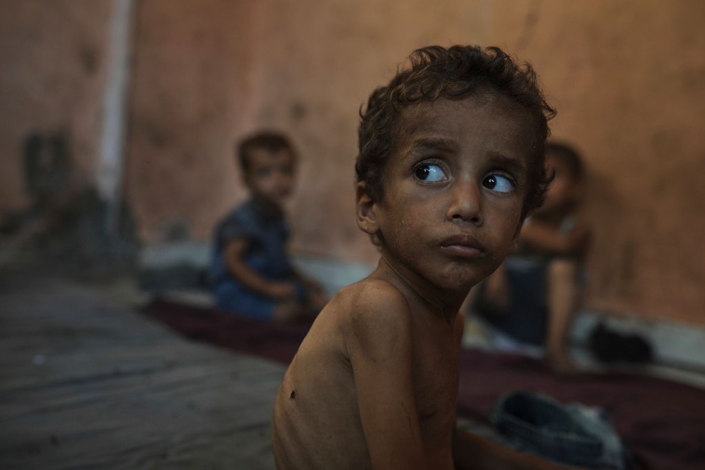 A closeup of a malnourished two year old sitting on the ground of a home