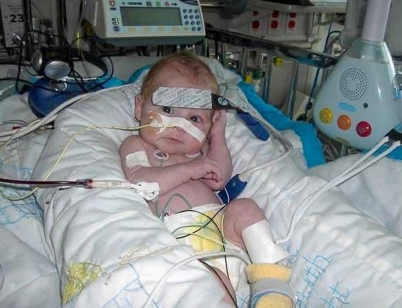 An infant lies in a hospital bed surrounded by medical equipment and monitors.